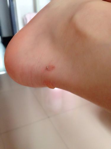 包含长跑鞋容易磨破脚后跟是什么问题的词条 包含长跑鞋容易磨破脚后跟是什么问题的词条 大精工智造